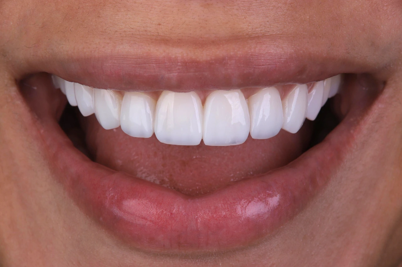 Caso-novo-1-SQR-dps (1)