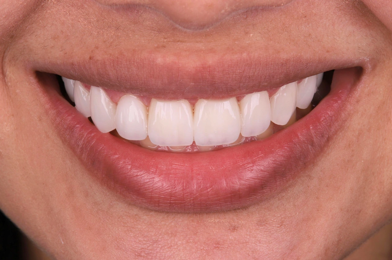 Caso-novo-2-SQR-dps (1)